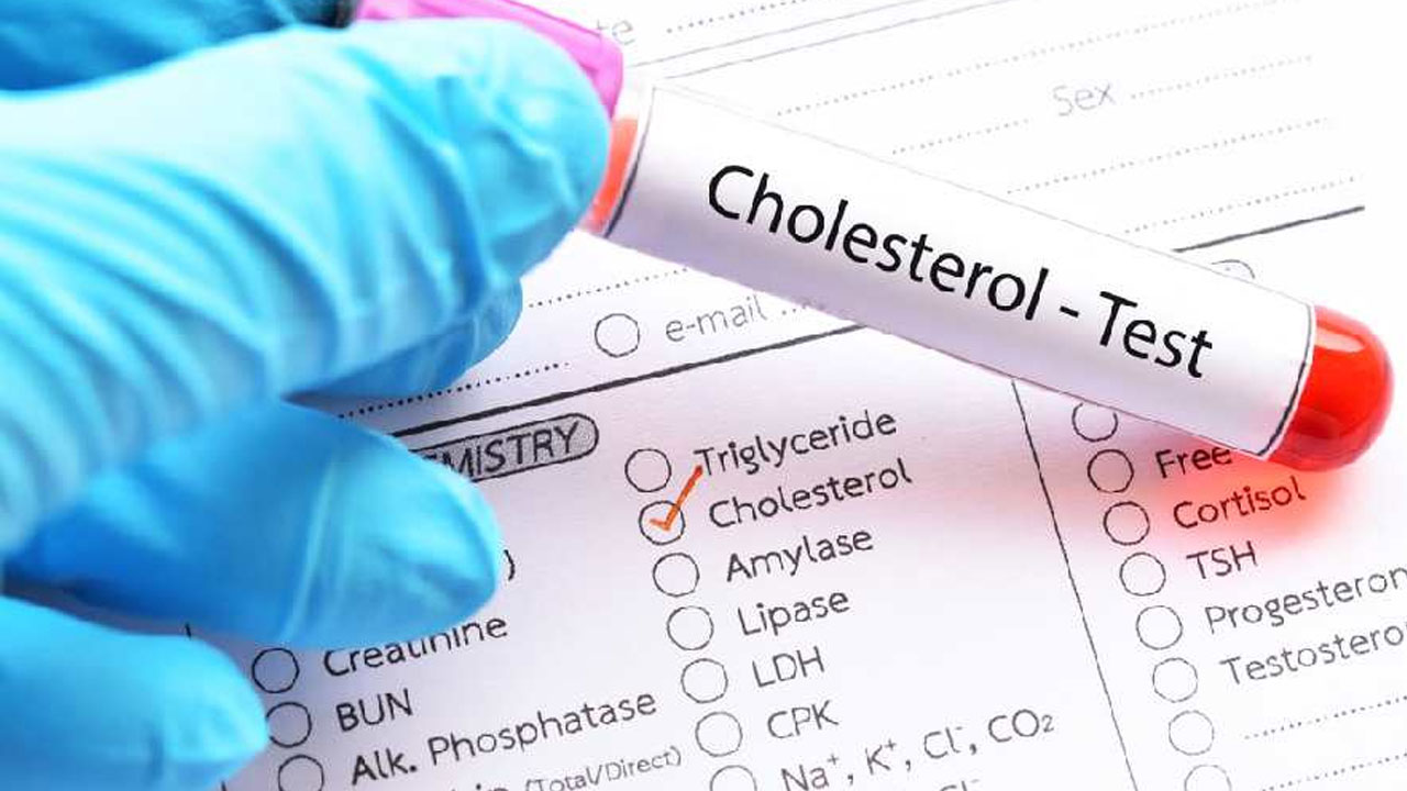 cholesterol-20240327092648.jpg